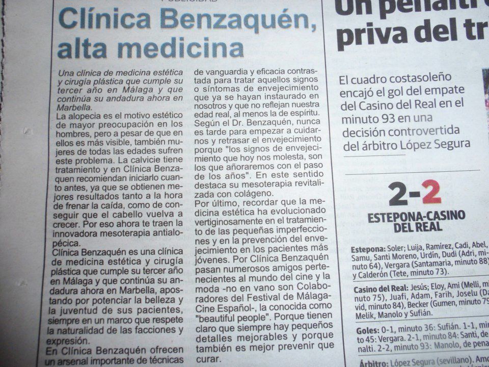 Clínica Benzaquén en Diario Sur, y su tratamiento de la calvicie