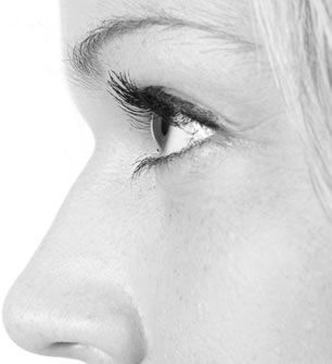 ojeras